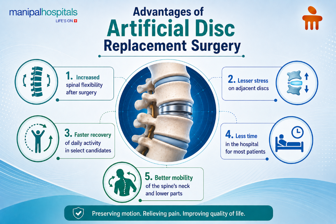 artificial-dis- replacement-vs-fusion